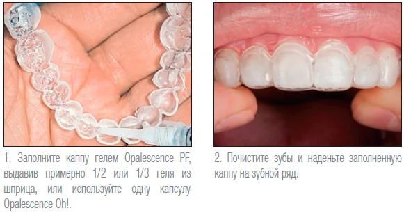 Инструкция по применению Opalescence