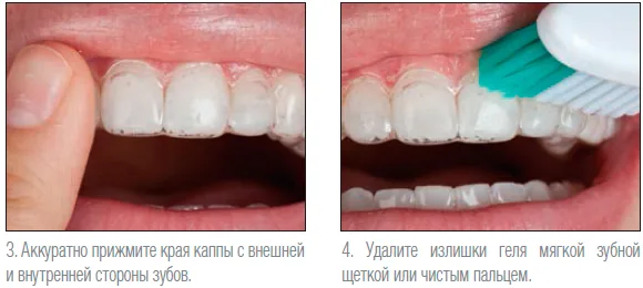 Инструкция по применению Opalescence