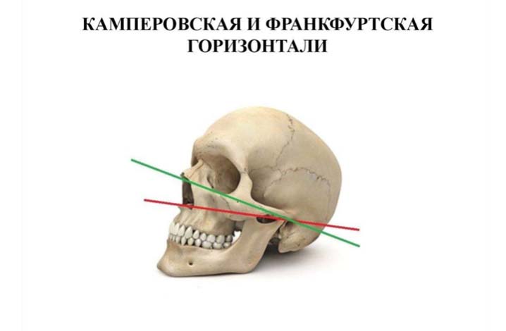 камперовской, франкфуртской