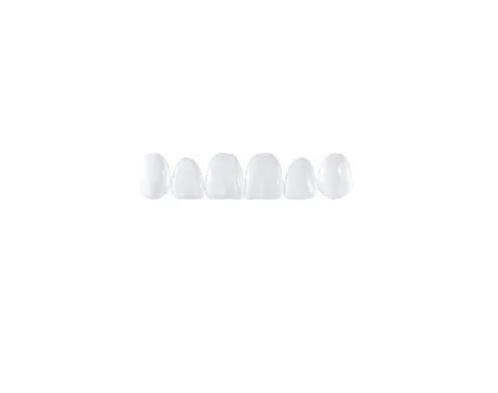 Гарнитур верхних виниров Componeer TM Set upper  6 шт. Veneers 11,12,13,21,22,23