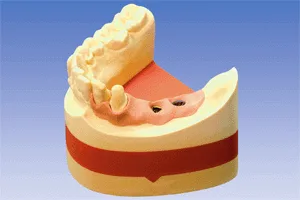 Implant rock (кремово-белый). Гипс 4 класса  3 кг.