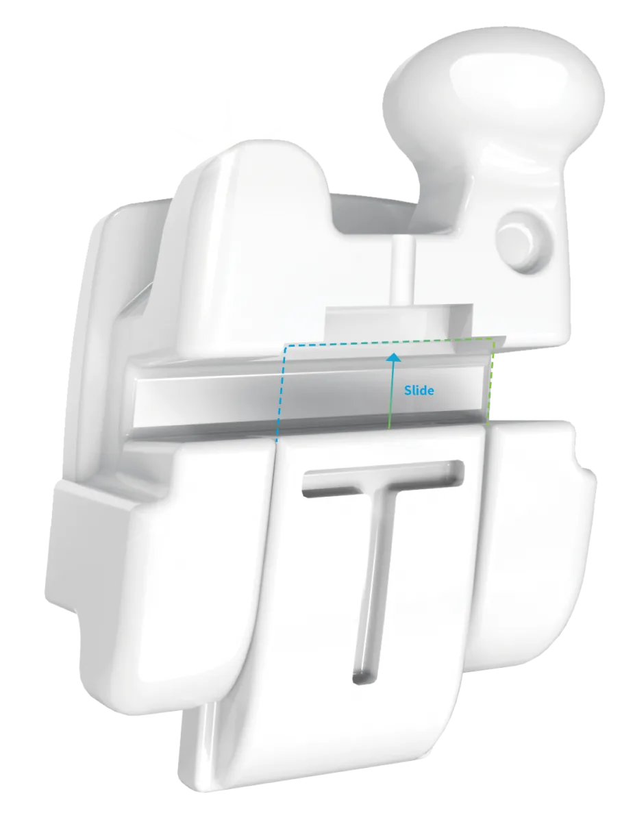Брекеты Biocetec S-line 0.22 (Roth) ВЧ 5-5 + НЧ 5-5 (20 шт)