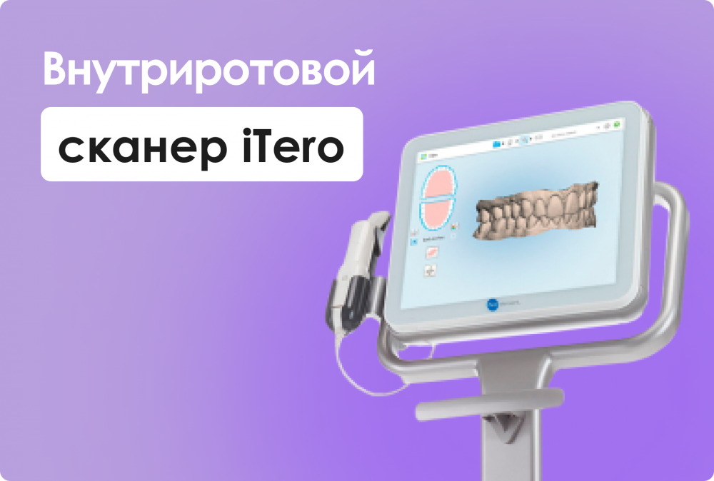 Внутриротовой сканер iTero