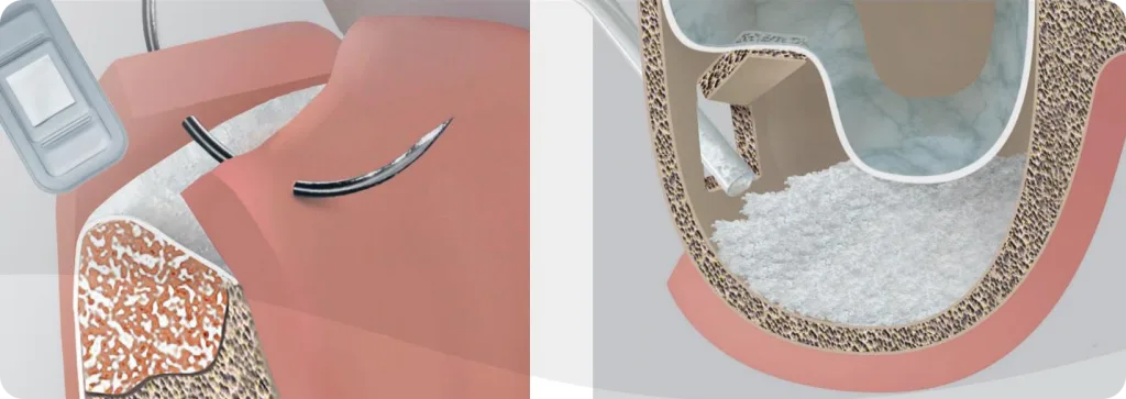 P1418_2020-06_A4-Br_Bone-Reg (1) 3.png