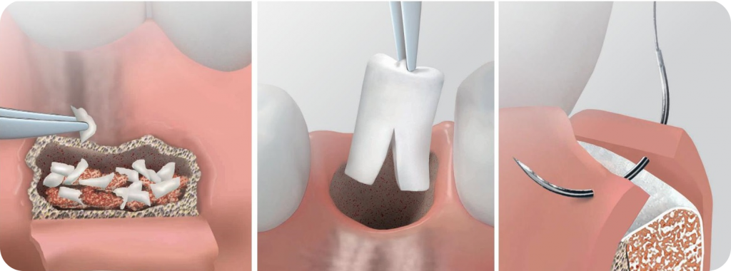 P1408_Common_Oral_Surgery_Screen (1) 1.png