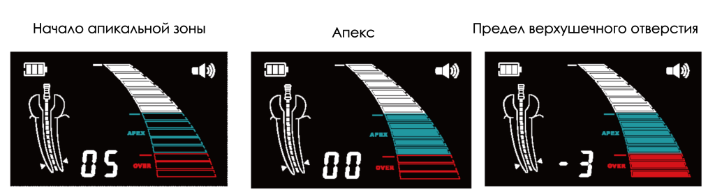 Dpex III индикация 