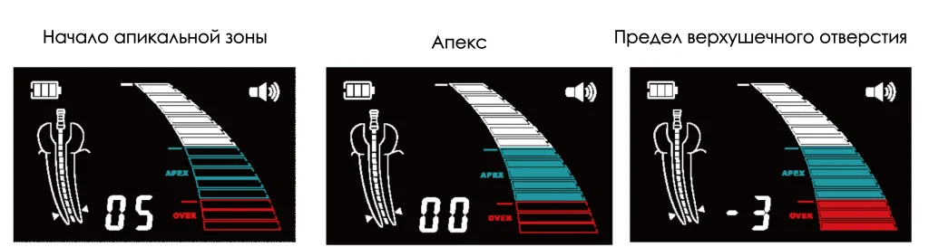 Dpex III индикация