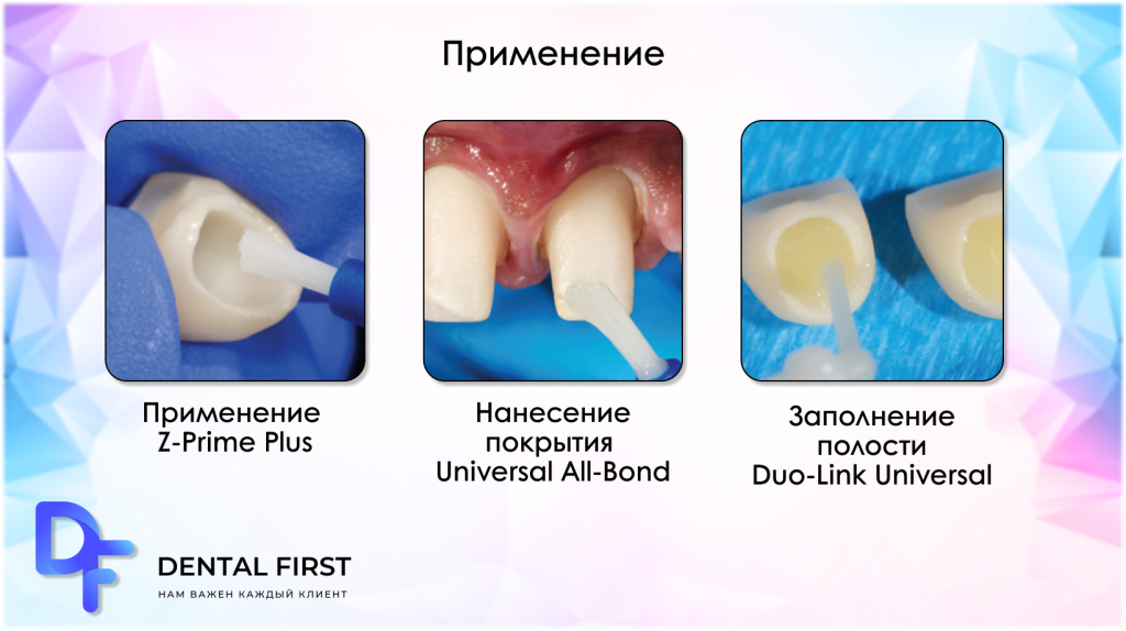 Адгезивы (адгезивные системы) 5 поколения для стоматологии в интернет-магазине 