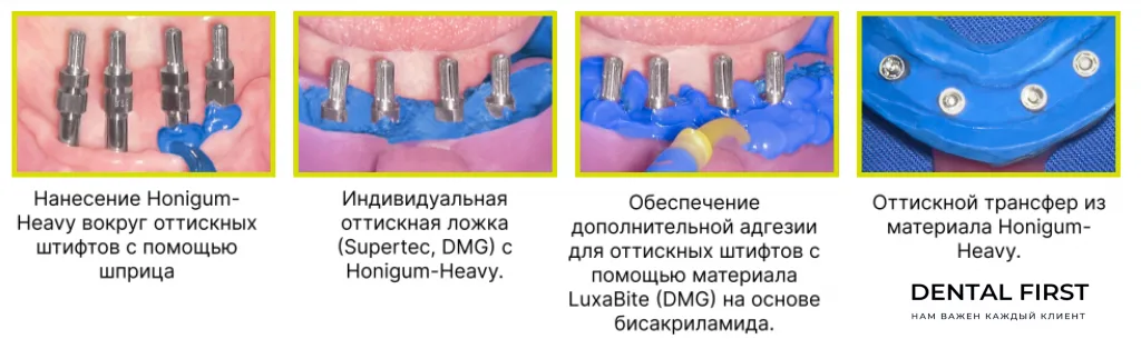 Оптимальная консистенция при внесении