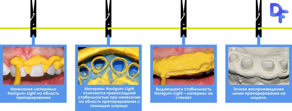 Хонигум лайт характеристики