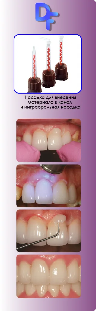 MaxCem Elite этапы применения
