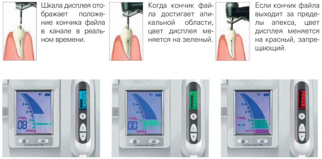 Root ZX mini индикация