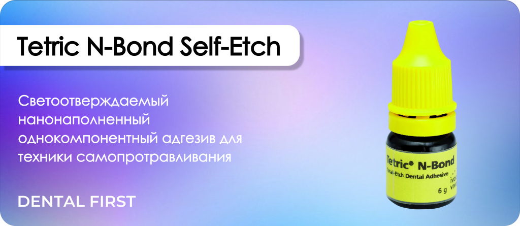 Tetric N-Bond Self-Etch