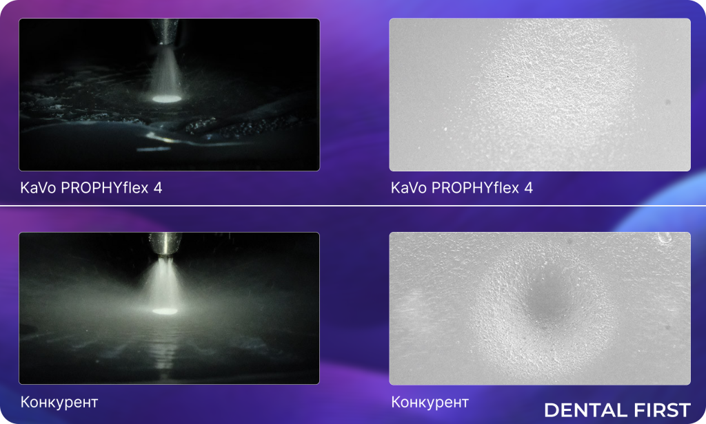 Преимущества Prophyflex 4 Kavo