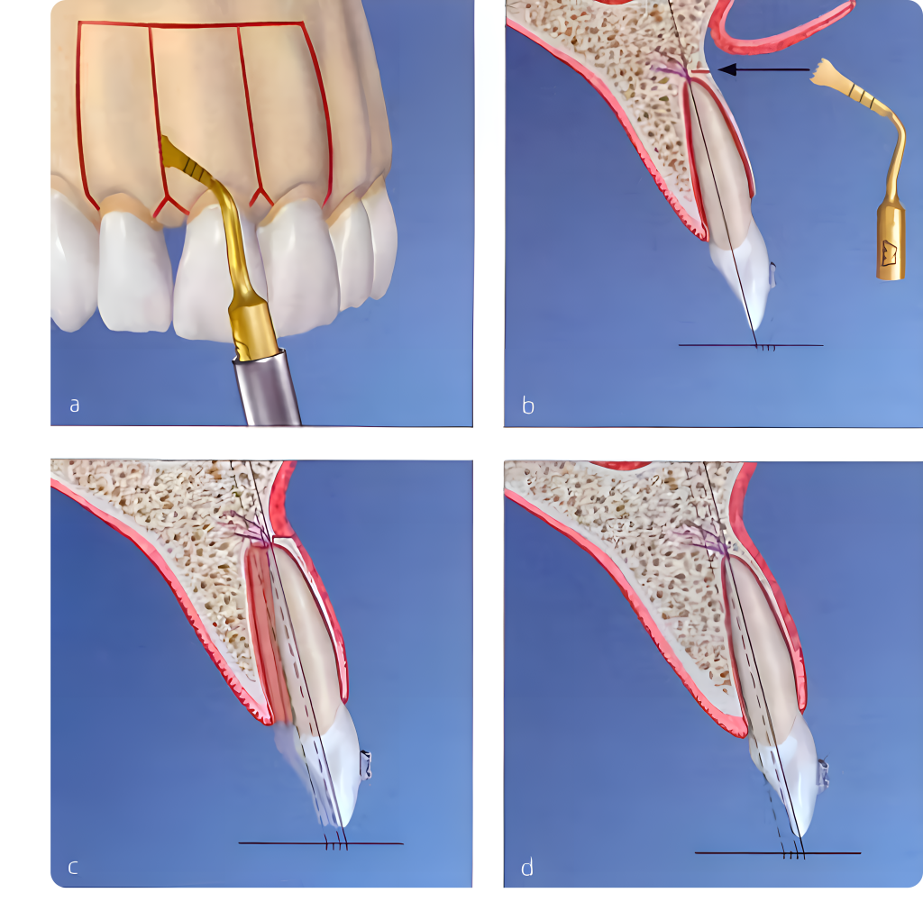 Surgery-X LED применение