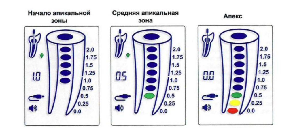 Forum novapex этапы