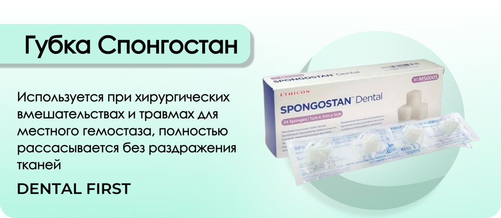 Губка Спонгостан