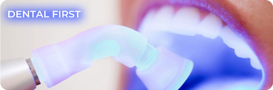 Лазерное отбеливание зубов