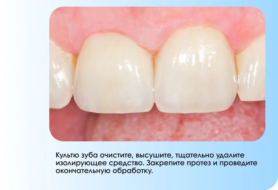 ВТОРАЯ.jpg