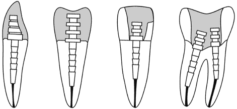 штифты штифты