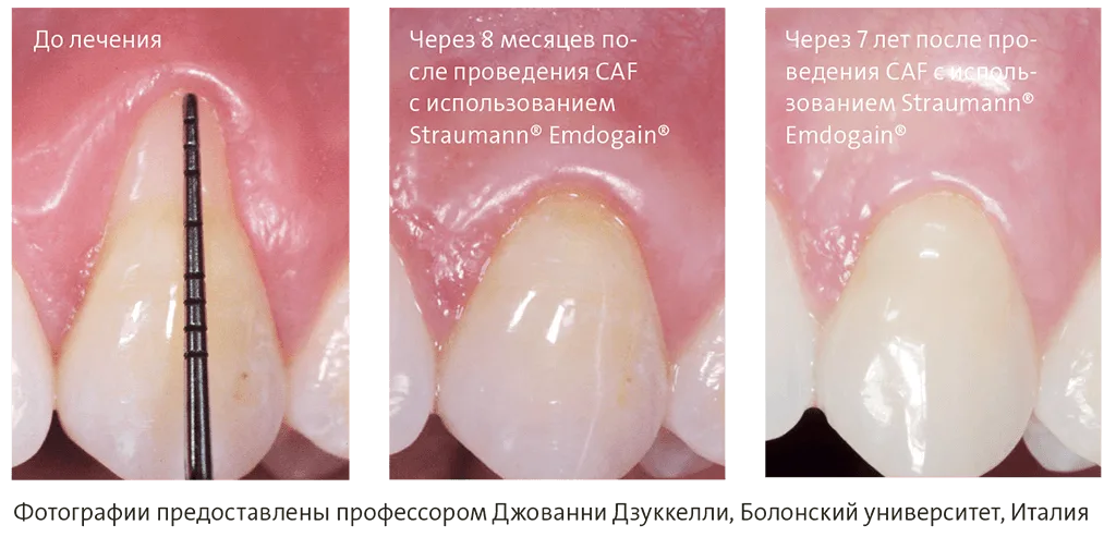 Эффект