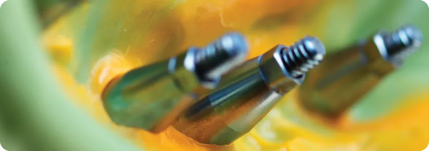 Component 9 1.png