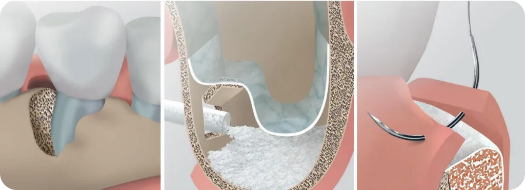 P1418_2020-06_A4-Br_Bone-Reg (1) 2.png