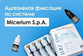 Адгезивная фиксация по системе Micerium s.p.a
