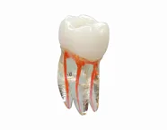 Эндо Трейнер Зуб (Endo Training tooth)