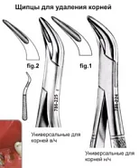 Щипцы универсальные для удаления корней верхней челюсти, fig. 2, Surgicon