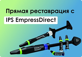 Актуальная концепция эстетичной реставрации переднего зуба. Изготовление прямой композитной реставрации с помощью IPS Empress Direct