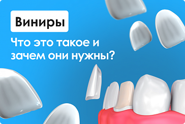 Виниры