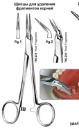 Щипцы для удаления фрагментов корней, fig. 1, Surgicon