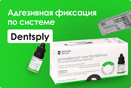 Адгезивная фиксация по системе Dentsply
