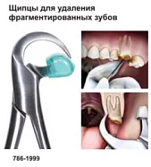 786-1999. Щипцы для удаления фрагментированных зубов 