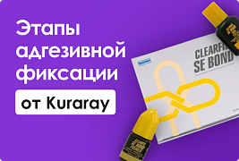 Этапы адгезивной фиксации от Kuraray