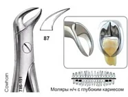 Щипцы №87, Surgicon - для удаления моляров нижней челюсти с глубоким кариесом